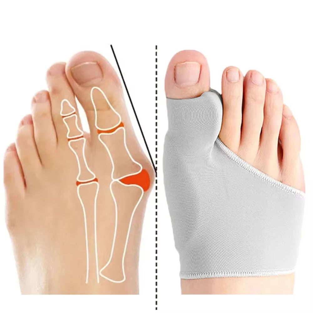 👣 Toe Corrector Orthotics – Foot Care